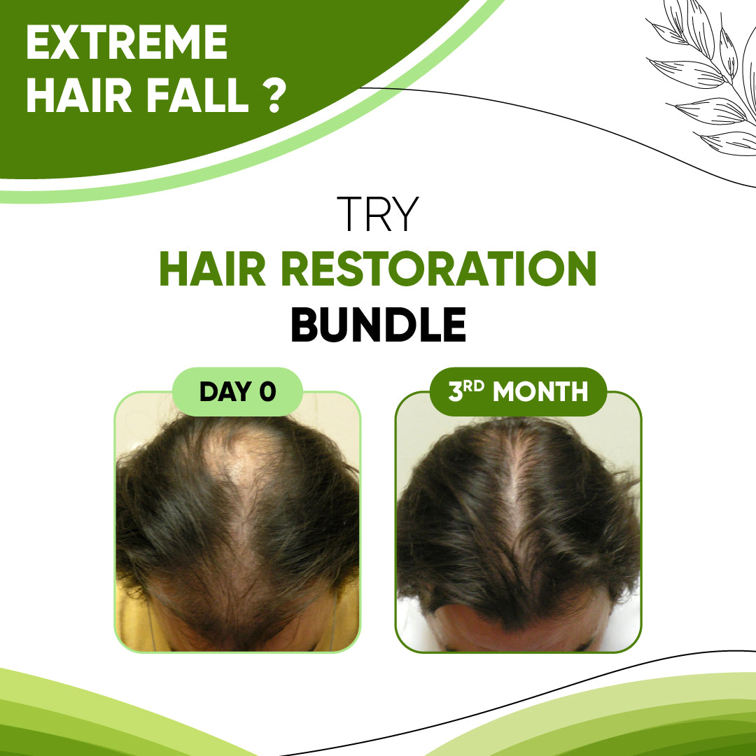 Setagrow Anti Hair Fall Spray (With Biotin & Xylishine)