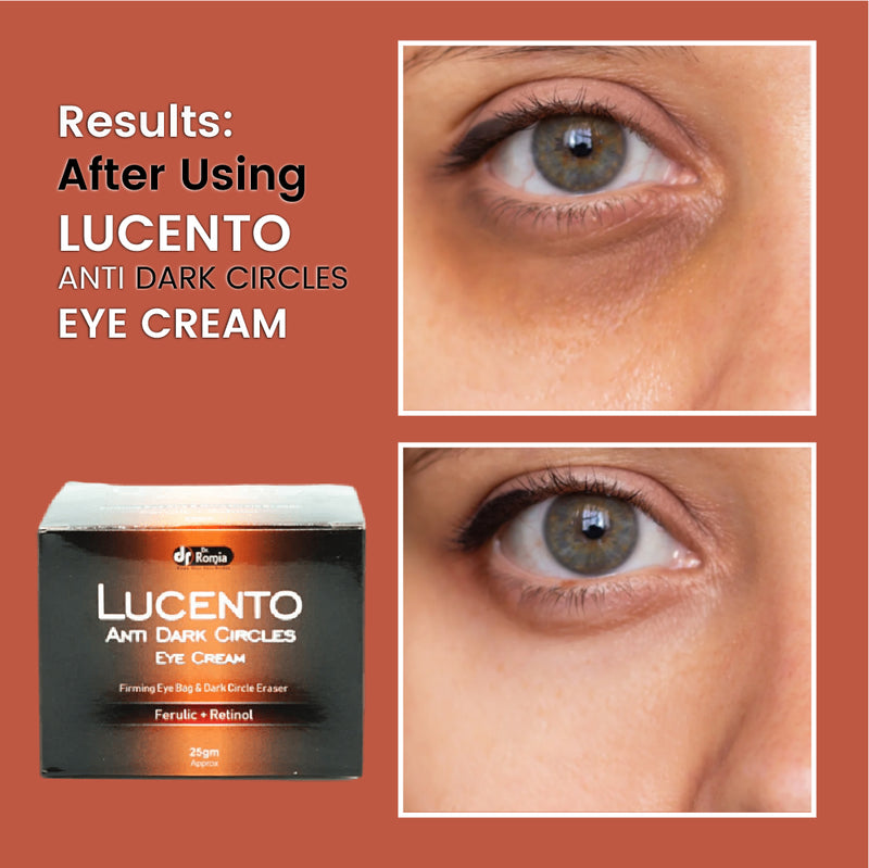 Cream For Dark Circles – Lucento Eye Cream