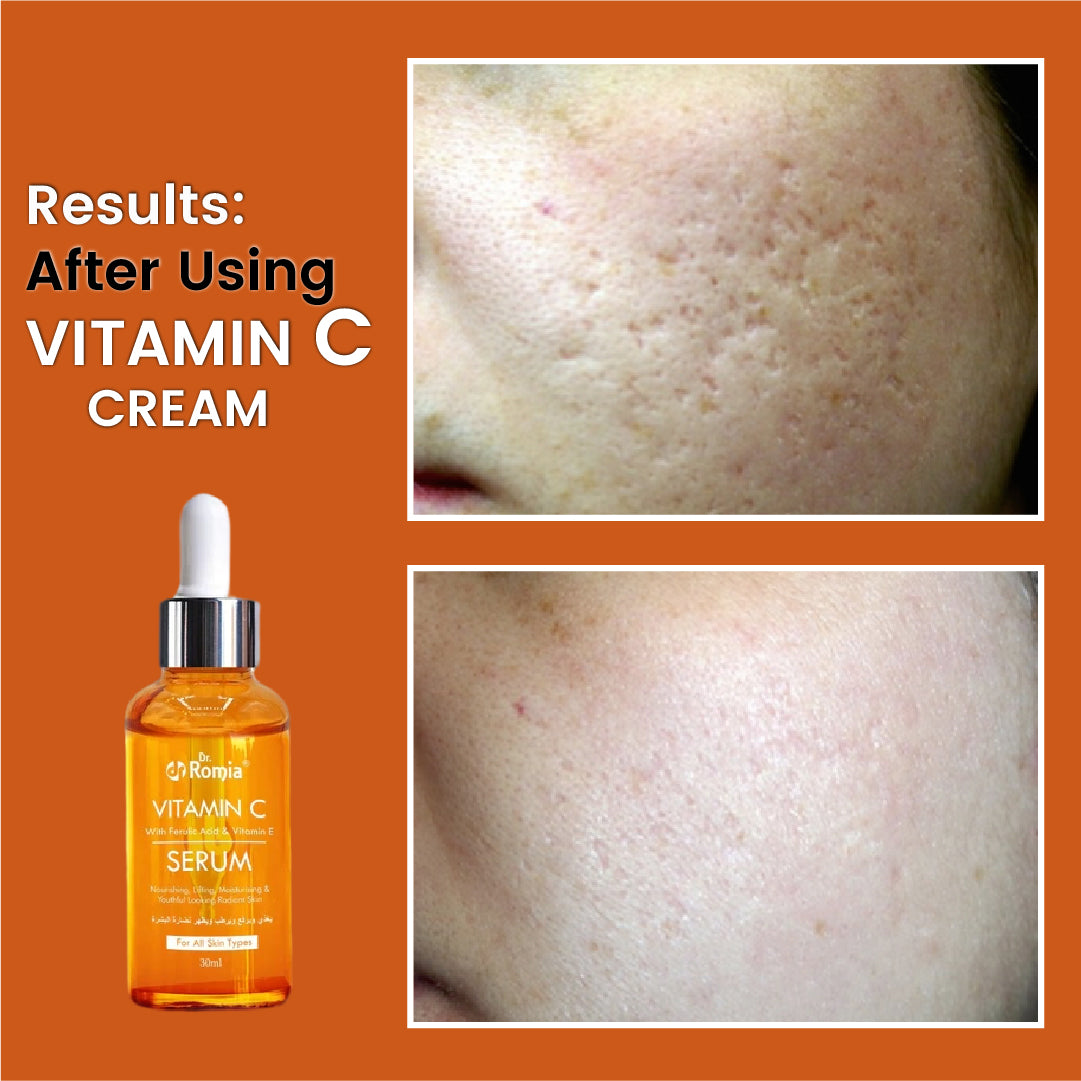 Vitamin C Serum (With Ferulic Acid & Vitamin E)