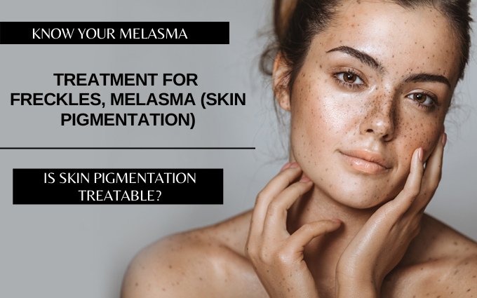 TREATMENT FOR FRECKLES, MELASMA (SKIN PIGMENTATION)