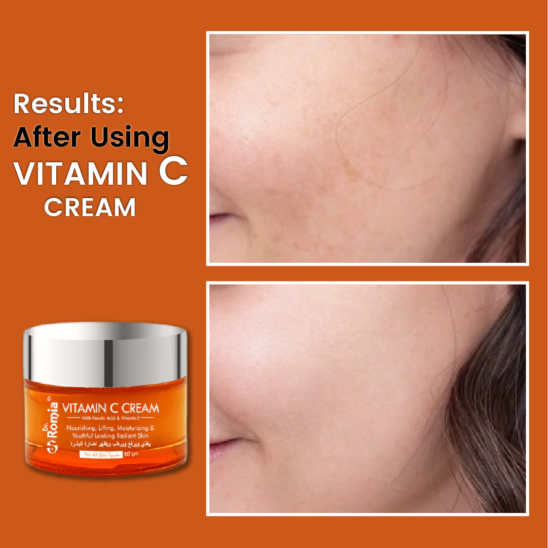 Vitamin C Cream With Ferulic Acid & Vitamin E – Dr.Romia