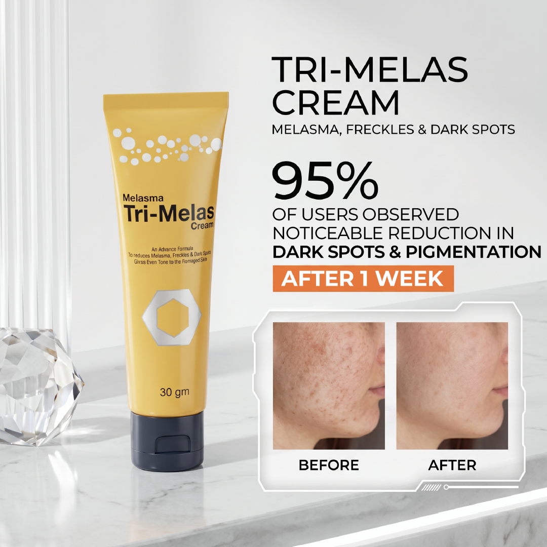 Tri Melas Cream - Best Melasma Cream